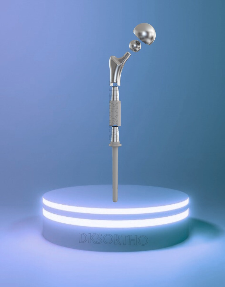 Proximal Femur Prosthesis System